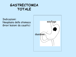 GASTRECTOMIA