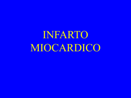 INFARTO MIOCARDICO