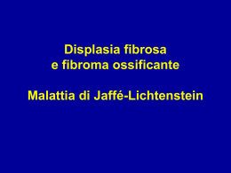 15-Displasia fibosa