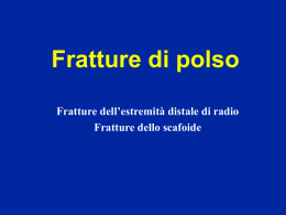 Polso - Fratture
