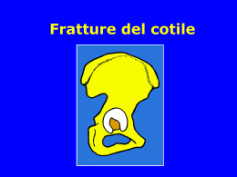 Fratture del Cotile - lerat