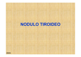 NODULO TIROIDEO