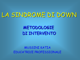 Sindrome di down
