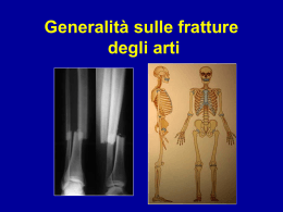 Fratture generalit&agrave;
