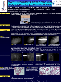 Poster - Asl TO4