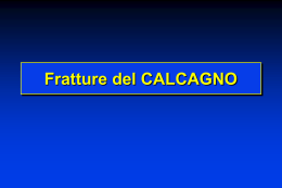 Fratture del calcagno - lerat