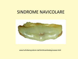 Sindrome navicolare