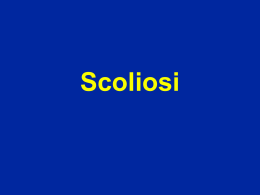 Spondylolisth&eacute;sis - lerat