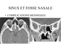 SINUS ET FOSSE NASALE