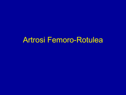 Artosi Femoro-rotulea - lerat