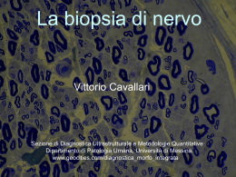 La biopsia di nervo