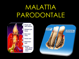 MALATTIE PARODONTALI