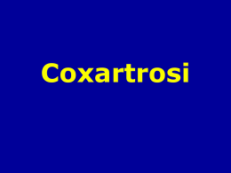 Coxartrosi