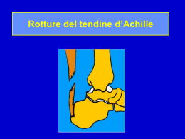 Rottura del tendine d`Achille - lerat