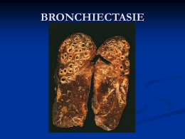 Bronchiectasie e pneumotorace