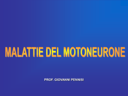 Malattie del motoneurone