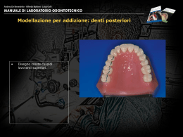 Modellazione per addizione: denti posteriori
