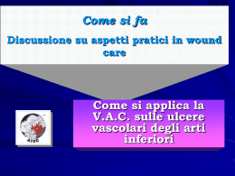 Ma cos`&egrave; la VAC?