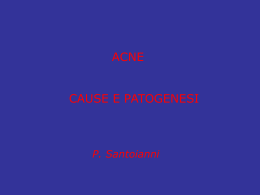 acne cause e patogenesi