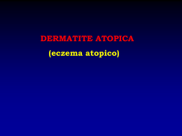 DERMATITE ATOPICA ppt