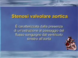 Valvulopatie aortiche