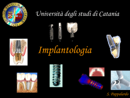 Implantologia - cenni storici