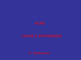 Acne - Cause e patogenesi