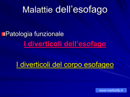 Malattie Dell Esofago - Diverticoli Del Corpo Esofageo (Pps 7687 Kb)
