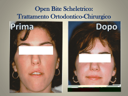 Trattamento Chirurgico-Ortodontico