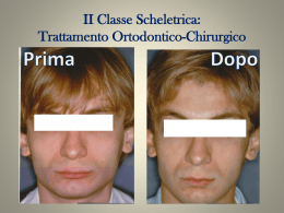 Trattamento Chirurgico