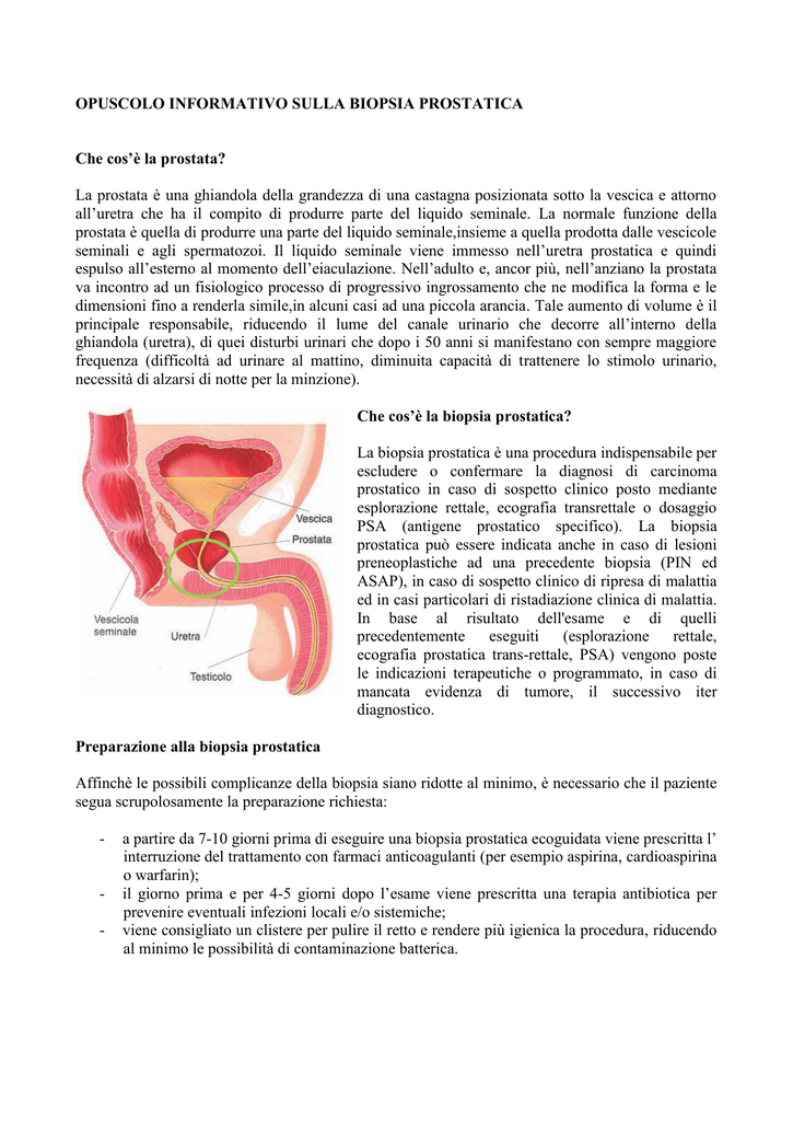 biopsia della prostata inoltre enteroclisi in ospedale