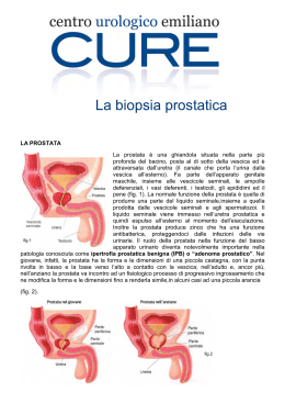 La biopsia prostatica - Centro Urologico Emiliano