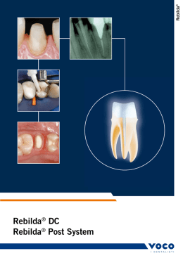 Rebilda® dc Rebilda® Post System