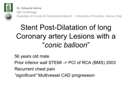 Stent Post-Dilatation of long Coronary artery