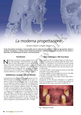 La moderna progettazione
