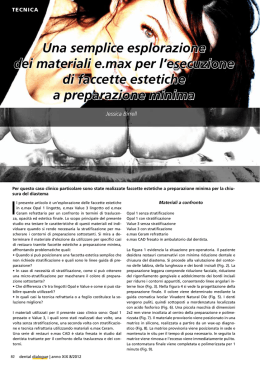 Una semplice esplorazione dei materiali e.max per l`esecuzione di
