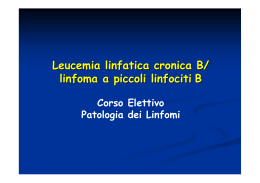 Leucemia linfatica cronica B/ linfoma a piccoli linfociti B