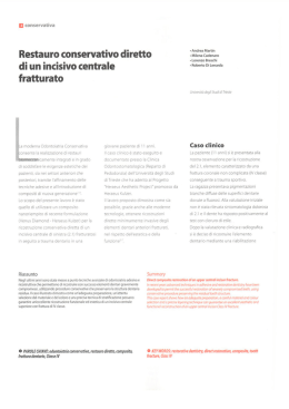 Restauro conservativo diretto di un incisivo centrale fratturato