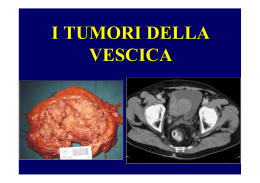 Tumore della Vescica - Università degli Studi di Trieste