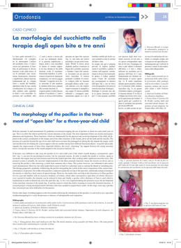 Zeitungsartikel Perfect A4_2.indd