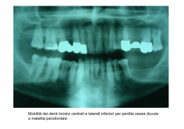 Mobilità dei denti incisivi centrali e laterali inferiori per perdita ossea