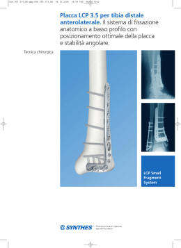 Placca LCP 3.5 per tibia distale anterolaterale. Il