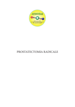 Consenso informato prostatectomia radicale