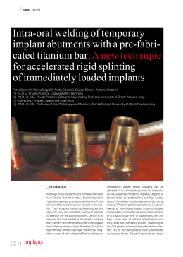 Intra-oral welding of temporary implants abutments with a pre