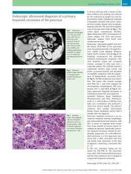 Endoscopic ultrasound diagnosis of a primary hepatoid