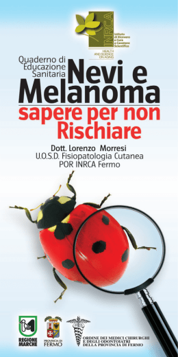 Nevi e Melanoma
