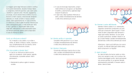 Cos`&egrave; un infortunio ai denti? Che cosa potete e dovete fare? Se il