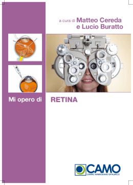 retina retina