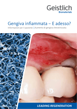 Gengiva infiammata – E adesso? - Geistlich Biomaterials Italia